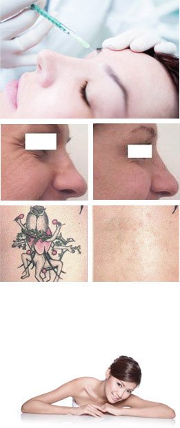 Before and After