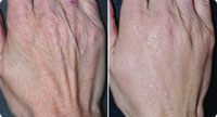 hands 